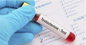 Testosterone_Standard